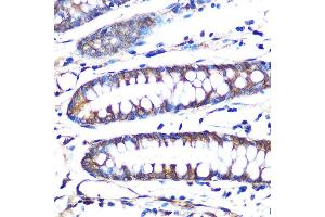 Immunohistochemistry of paraffin-embedded human colon using Aromatase (CYP19) Rabbit mAb (2238) at dilution of 1:100 (40x lens). (Aromatase anticorps)