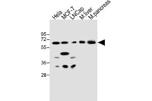 All lanes : Anti-CBS Antibody (Center) at 1:500 dilution Lane 1: Hela whole cell lysate Lane 2: MCF-7 whole cell lysate Lane 3: LNCap whole cell lysate Lane 4: mouse liver lysate Lane 5: mouse pancreas lysate Lysates/proteins at 20 μg per lane. (CBS anticorps  (AA 301-330))