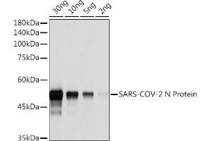 Western blot analysis of SARS-COV-2 N Protein using SARS-COV-2 N Protein Rabbit pAb (ABIN7269049) at 1:1000 dilution. (Nucleoprotein anticorps)
