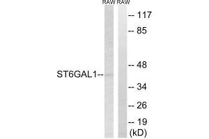 Western Blotting (WB) image for anti-ST6 beta-Galactosamide alpha-2,6-Sialyltranferase 1 (ST6GAL1) (Internal Region) antibody (ABIN1851134) (ST6GAL1 anticorps  (Internal Region))