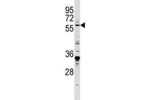 EGR1 antibody western blot analysis in MDA-MB231 lysate.