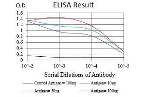 Black line: Control Antigen (100 ng), Purple line: Antigen(10 ng), Blue line: Antigen (50 ng), Red line: Antigen (100 ng),