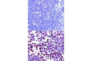 Noxa Immunohistochemistry. (NOXA anticorps)