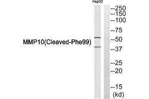 Western Blotting (WB) image for anti-Matrix Metallopeptidase 10 (Stromelysin 2) (MMP10) (Cleaved-Phe99) antibody (ABIN1853588) (MMP10 anticorps  (Cleaved-Phe99))