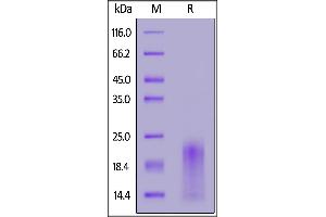 Cynomolgus BAFFR, His Tag on  under reducing (R) condition.