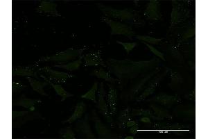Immunofluorescence of monoclonal antibody to ADAMTS1 on HeLa cell.