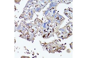 Immunohistochemistry of paraffin-embedded human placenta using Complement factor H Rabbit pAb (ABIN3023096, ABIN3023097, ABIN3023098 and ABIN6219387) at dilution of 1:100 (40x lens).