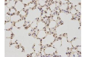 Immunohistochemistry (IHC) image for anti-Thymopoietin (TMPO) antibody (ABIN1875122) (Thymopoietin anticorps)