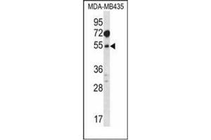 Western blot analysis of MAT1A Antibody (N-term) in MDA-MB435 cell line lysates (35ug/lane). (MAT1A anticorps  (N-Term))