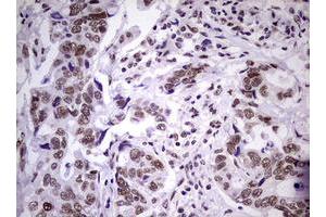 Image no. 3 for anti-Nibrin (NBN) (AA 183-460) antibody (ABIN1491066)