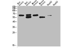 Western blot analysis of 1) Rat Brain Tissue-Low Molecular Protein Marker, 2)Rat Brain Tissue-High Molecular Protein Marker, 3) Mouse Brain Tissue-Low Molecular Protein Marker, 4) Mouse Brain Tissue- High Molecular Protein Marker, 5) HepG2-Low Molecular P (KCNH5 anticorps)