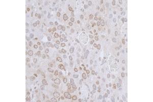 Immunohistochemistry (IHC) image for anti-LAP2 beta/tmpo (AA 225-275) antibody (ABIN7455055) (LAP2 beta/tmpo (AA 225-275) anticorps)