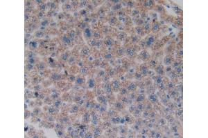 Used in DAB staining on fromalin fixed paraffin- embedded liver tissue (FOS anticorps  (AA 6-240))