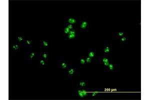 Immunofluorescence of purified MaxPab antibody to DDX47 on HeLa cell. (DDX47 anticorps  (AA 1-455))