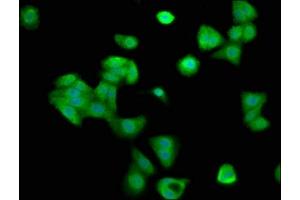 Immunofluorescence staining of HepG2 cells with ABIN7148955 at 1:200, counter-stained with DAPI. (Cyclin Y anticorps  (AA 2-170))