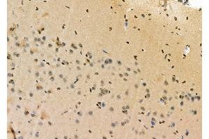 ABIN6254892 and ABIN6276334 at 1/100 staining Rat brain tissue by IHC-P.