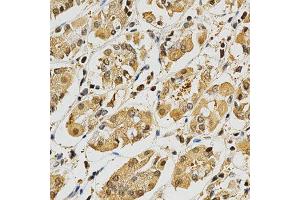 Immunohistochemistry of paraffin-embedded human stomach using PLK1 antibody at dilution of 1:200 (x400 lens) (PLK1 anticorps)