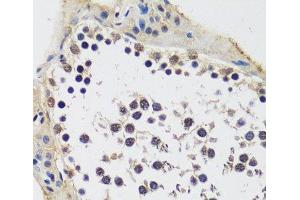 Immunohistochemistry of paraffin-embedded Rat testis using CCDC59 Polyclonal Antibody at dilution of 1:100 (40x lens). (CCDC59 anticorps)