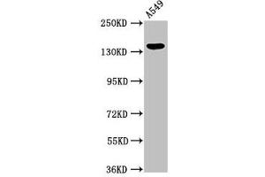 Western Blot Positive WB detected in: A549 whole cell lysate All lanes: PLIN4 antibody at 2.