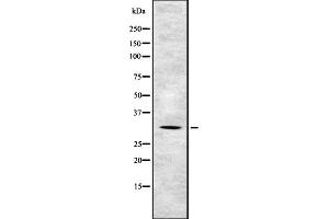 Western blot analysis of TSSC4 expression in HEK293 cells ,The lane on the left is treated with the antigen-specific peptide.