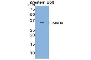 anti-C2 Calcium-Dependent Domain Containing 3 (C2CD3) (AA 2051-2323) antibody