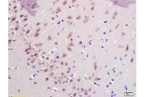 Formalin-fixed and paraffin embedded rat brain labeled with Anti-SHANK3 Polyclonal Antibody, Unconjugated (ABIN1386707) at 1:200 followed by conjugation to the secondary antibody and DAB staining