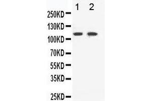 Anti-Eph receptor B3 antibody, Western blotting Lane 1: HELA Cell Lysate Lane 2: A549 Cell Lysate