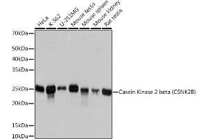 Western blot analysis of extracts of various cell lines, using Casein Kinase 2 beta (CSNK2B) (CSNK2B) Rabbit mAb (ABIN1680593, ABIN3019007, ABIN3019008 and ABIN7101698) at 1:1000 dilution.