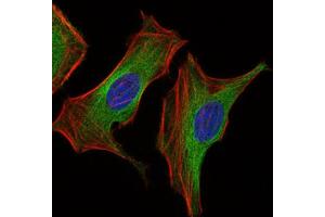 Immunocytochemistry (ICC) image for anti-Insulin-Like Growth Factor 2 (IGF2) (AA 25-180) antibody (ABIN1846026) (IGF2 anticorps  (AA 25-180))