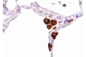 ABIN6267455 at 1/100 staining human bone tissue sections by IHC-P. (SHP1 anticorps  (pTyr536))