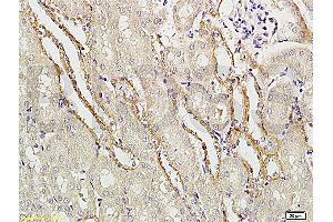 Formalin-fixed and paraffin embedded rat brain tissue labeled with Rabbit Anti-APG5L/ATG5 Polyclonal Antibody (ABIN752413) at 1:200 followed by conjugation to the secondary antibody and DAB staining. (ATG5 anticorps  (AA 101-200))