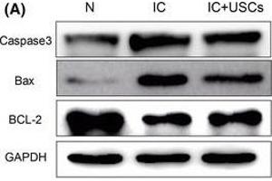 Analysis of protein expression of the apoptosis biomarkers caspase 3 and Bax and the antiapoptosis indicator BCL-2 and a TUNEL assay in the urinary bladder at 4 days after IC induction (n=5).