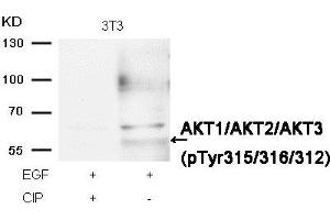 Western blot analysis of extracts from 3T3 cells, treated with EGF or calf intestinal phosphatase (CIP), using AKT1/AKT2/AKT3 (phospho-Tyr315/316/312) Antibody. (AKT1 anticorps  (pTyr312, pTyr315, pTyr316))