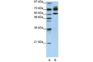 ADARB1 antibody used at 1. (RED1 anticorps)