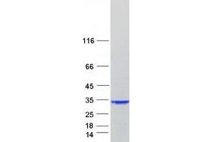 Validation with Western Blot
