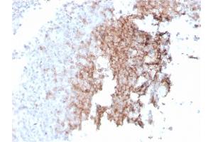 Formalin-fixed, paraffin-embedded human spleen stained with CD21 Recombinant Mouse Monoclonal Antibody (rCR2/1952). (Recombinant CD21 anticorps  (AA 44-196))