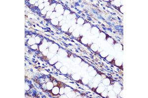 Immunohistochemistry of paraffin-embedded Human colon using LETMD1 Rabbit pAb (ABIN3023040, ABIN3023041, ABIN3023042, ABIN1513151 and ABIN6219360) at dilution of 1:100 (40x lens).