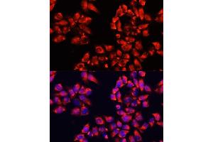Immunofluorescence analysis of HeLa cells using  antibody (ABIN6133474, ABIN6136782, ABIN6136783 and ABIN6224731) at dilution of 1:100. (ALDH7A1 anticorps  (AA 430-539))