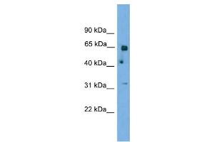 PNKP antibody used at 1 ug/ml to detect target protein. (PNKP anticorps  (N-Term))