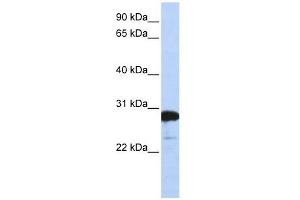RanBP1 antibody used at 1 ug/ml to detect target protein.