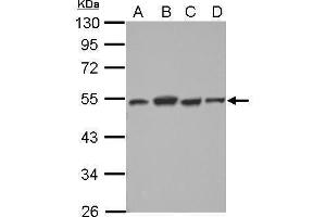 WB Image Sample (30 ug of whole cell lysate) A: NT2D1 B: PC-3 C: U87-MG D: SK-N-SH 10% SDS PAGE antibody diluted at 1:2000 (DTNBP1 anticorps)