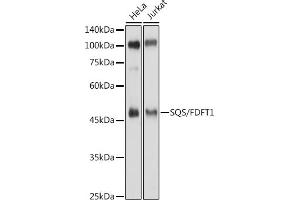 Western blot analysis of extracts of various cell lines, using SQS/FDFT1 antibody (ABIN6130393, ABIN6140567, ABIN6140568 and ABIN6221824) at 1:500 dilution. (FDFT1 anticorps  (AA 1-260))
