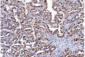 IHC analysis of FEN1 using anti-FEN1 antibody (ABIN7601618). (FEN1 anticorps  (AA 4-300))