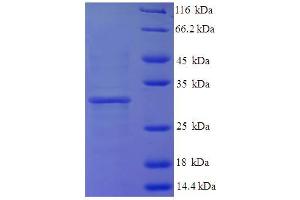 SDS-PAGE (SDS) image for H3 Histone, Family 3A (H3F3A) (AA 2-136) protein (His-SUMO Tag) (ABIN5709639)