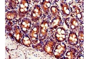 Immunohistochemistry of paraffin-embedded human small intestine tissue using ABIN7175937 at dilution of 1:100