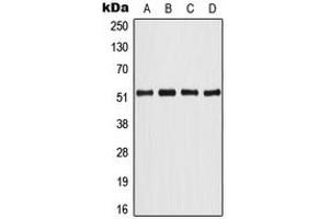 Western blot analysis of ATF2 expression in HeLa (A), NIH3T3 (B), PC12 (C), rat brain (D) whole cell lysates. (ATF2 anticorps  (Center))