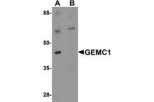 Western blot analysis of GEMC1 in mouse heart tissue lysate with GEMC1 antibody at 1 μg/mL in (A) the absence and (B) the presence of blocking peptide (GEMC1 anticorps  (Center))
