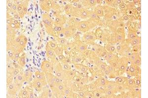 Immunohistochemistry of paraffin-embedded human liver tissue using ABIN7171658 at dilution of 1:100 (TBC1D7 anticorps  (AA 1-293))