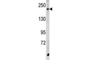 Western blot analysis of CPD antibody and HeLa lysate. (CPD anticorps  (AA 1019-1048))