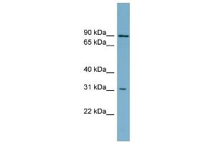WB Suggested Anti-ABCD2 Antibody Titration:  0. (CCL17 anticorps  (Middle Region))
